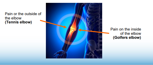 Graphic of a transparent arm with the elbow bone highlighted in orange.
